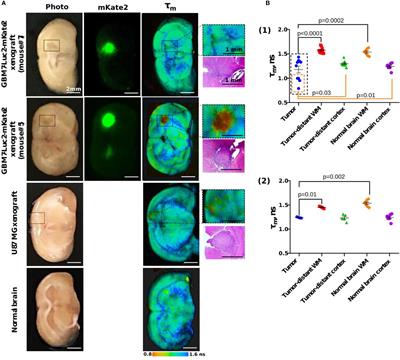 Corrigendum: Highly invasive fluorescent/bioluminescent patient-derived orthotopic model of glioblastoma in mice